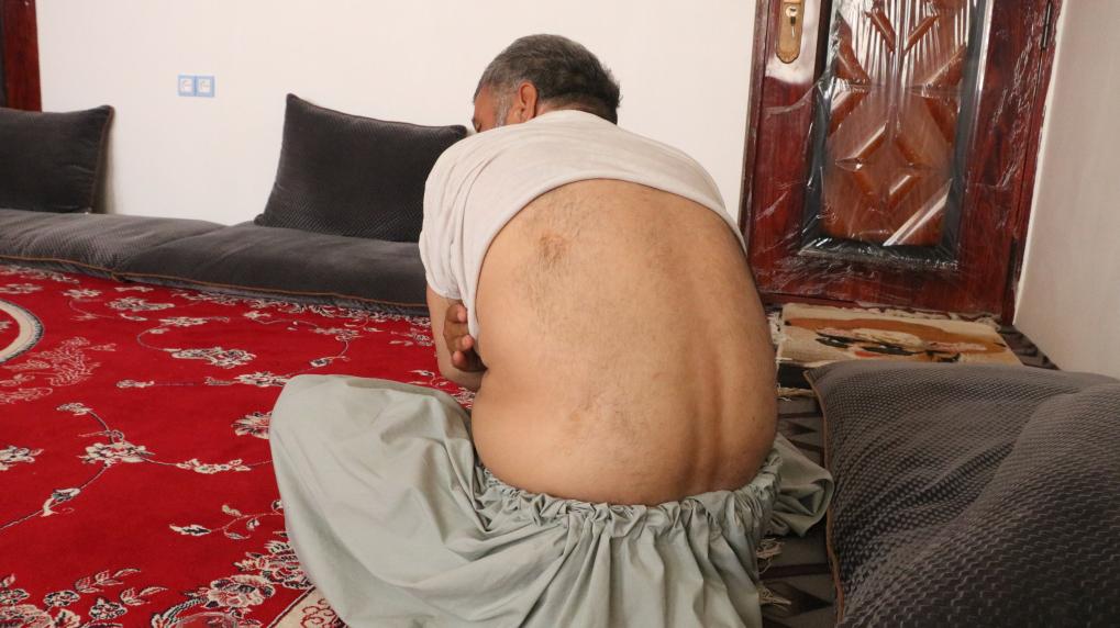 通訊：&ldquo;沒(méi)有人道歉或賠償&rdquo;&mdash;&mdash;阿富汗受害者控訴美軍使用集束炸彈